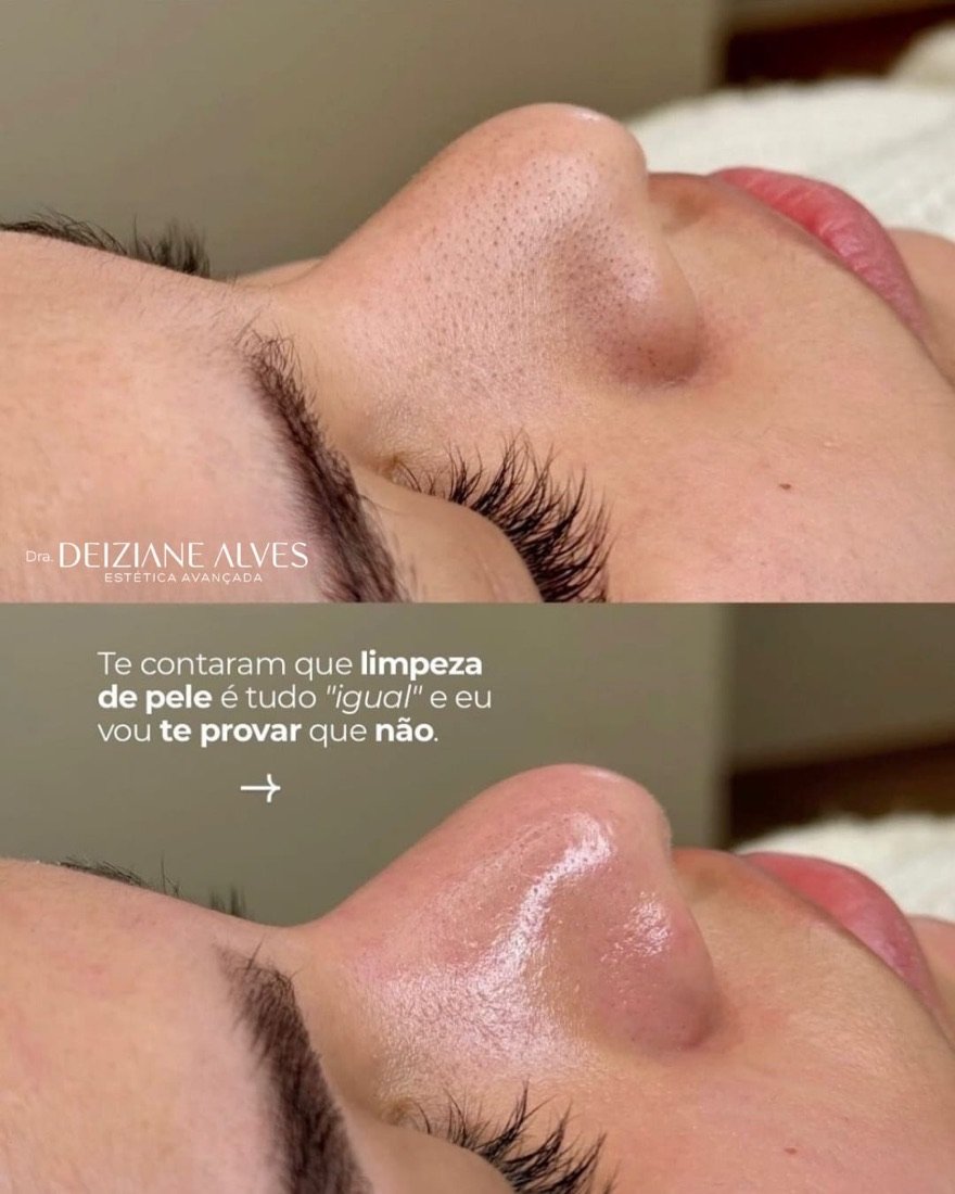 Publicação do Instituto Pró Esthétique no Instagram