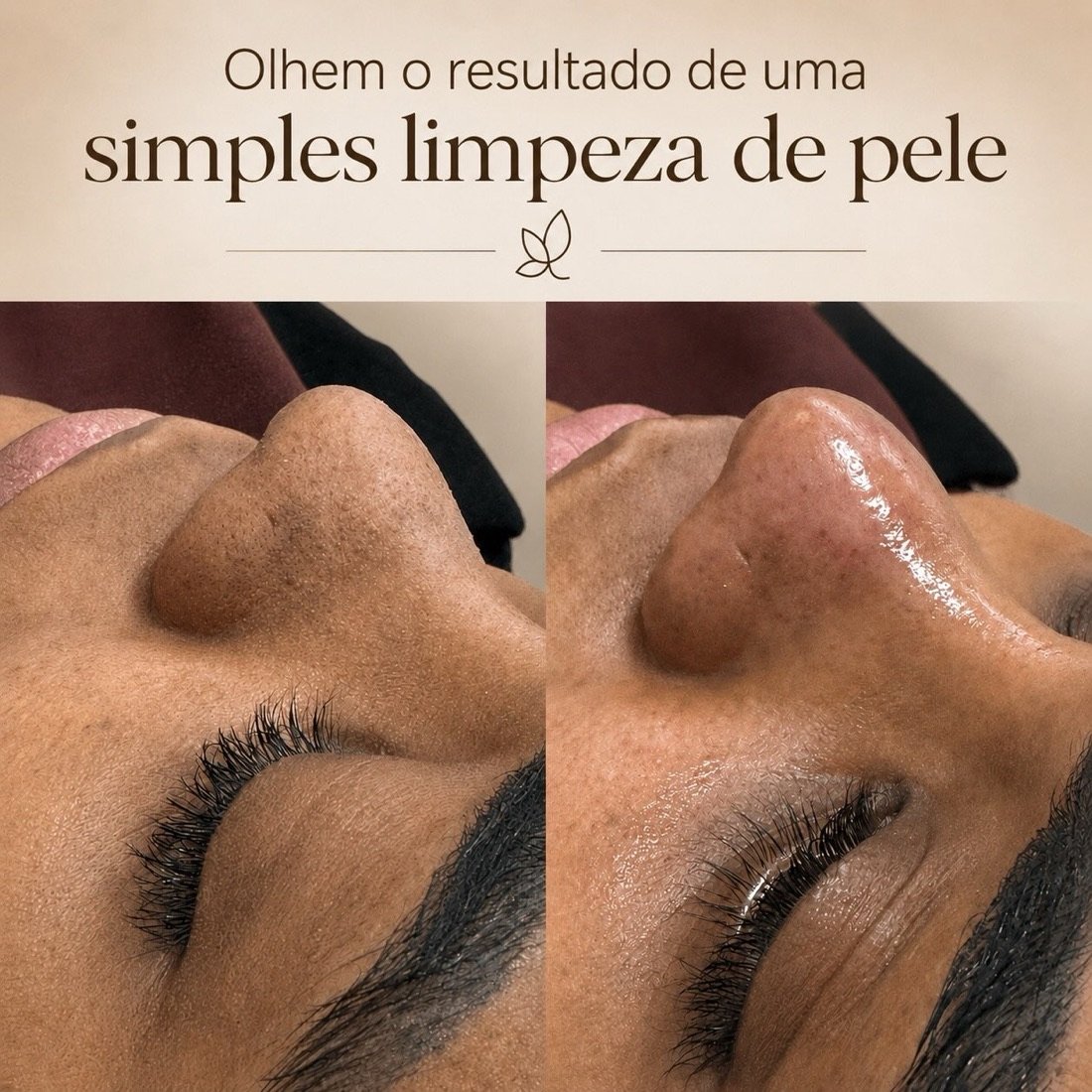 Publicação do Instituto Pró Esthétique no Instagram